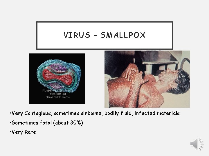 VIRUS – SMALLPOX • Very Contagious, sometimes airborne, bodily fluid, infected materials • Sometimes