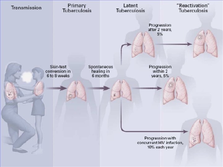 Natural History of TB Infection 