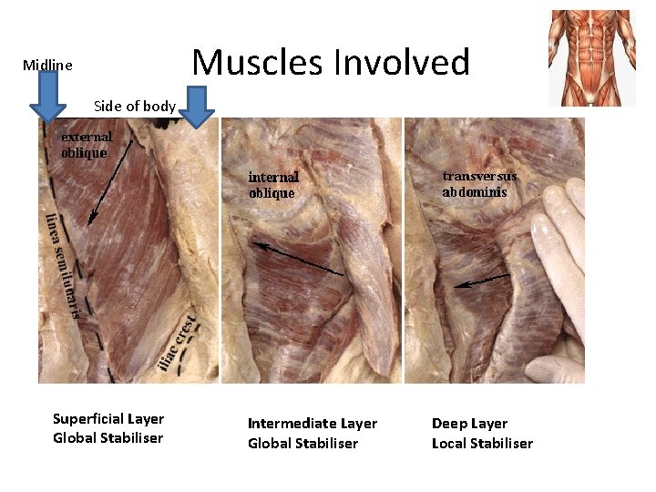 Muscles Involved Midline Side of body Superficial Layer Global Stabiliser Intermediate Layer Global Stabiliser
