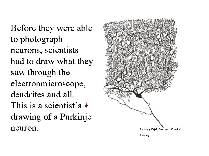 Before they were able to photograph neurons, scientists had to draw what they saw