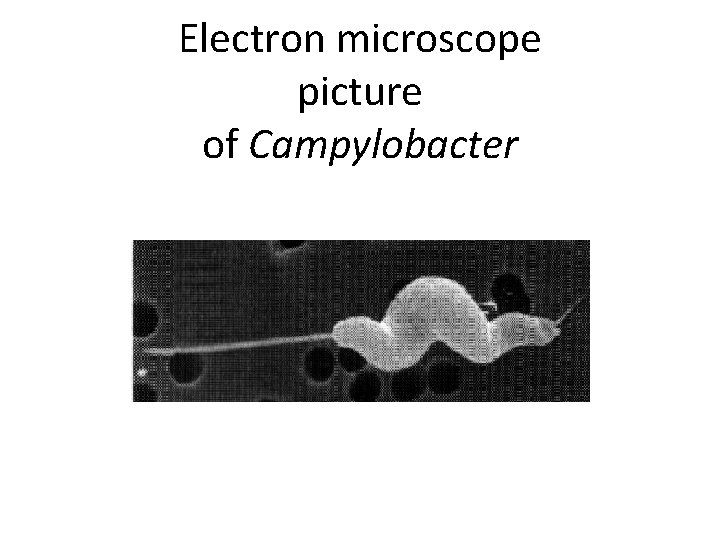 Electron microscope picture of Campylobacter 