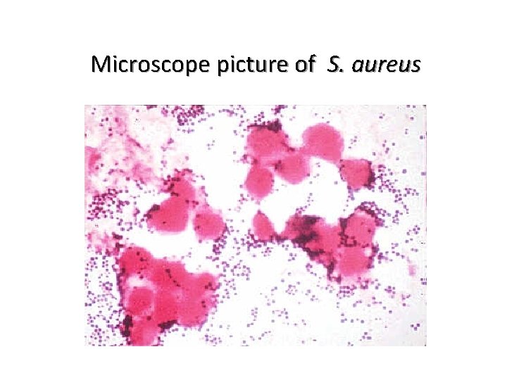 Microscope picture of S. aureus 
