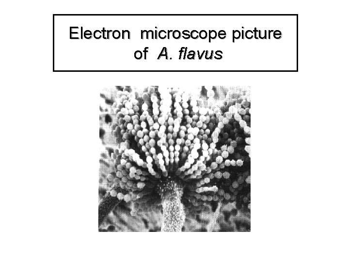 Electron microscope picture of A. flavus 