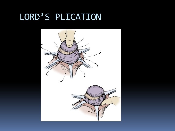 LORD’S PLICATION 