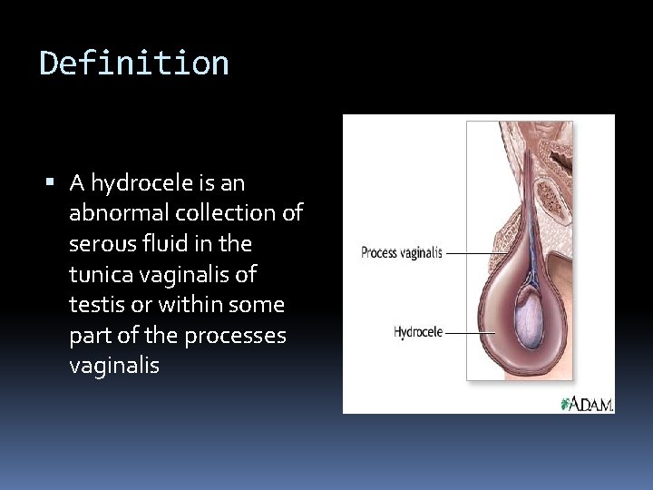 Definition A hydrocele is an abnormal collection of serous fluid in the tunica vaginalis