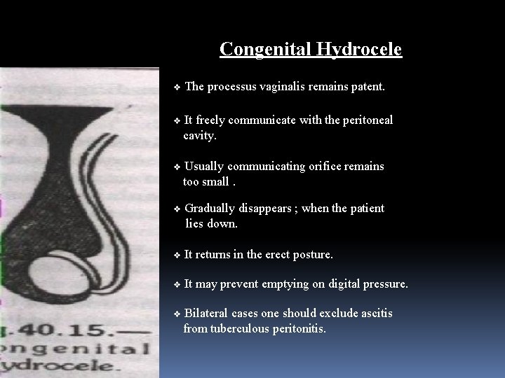 Congenital Hydrocele v The processus vaginalis remains patent. v It freely communicate with the