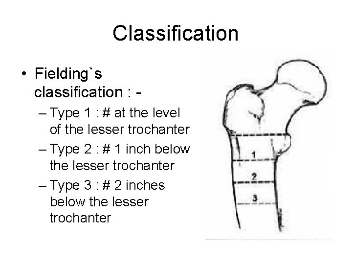 Classification • Fielding`s classification : – Type 1 : # at the level of