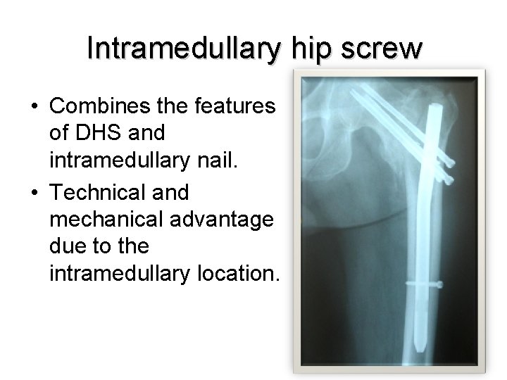 Intramedullary hip screw • Combines the features of DHS and intramedullary nail. • Technical