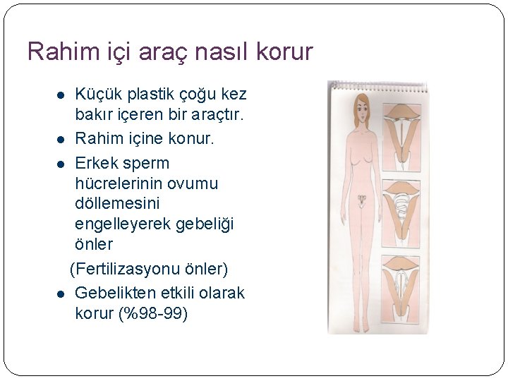 Rahim içi araç nasıl korur Küçük plastik çoğu kez bakır içeren bir araçtır. l