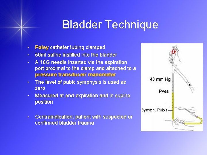 Bladder Technique • • • Foley catheter tubing clamped 50 ml saline instilled into