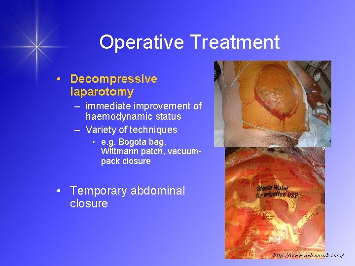 Operative Treatment • Decompressive laparotomy – immediate improvement of haemodynamic status – Variety of
