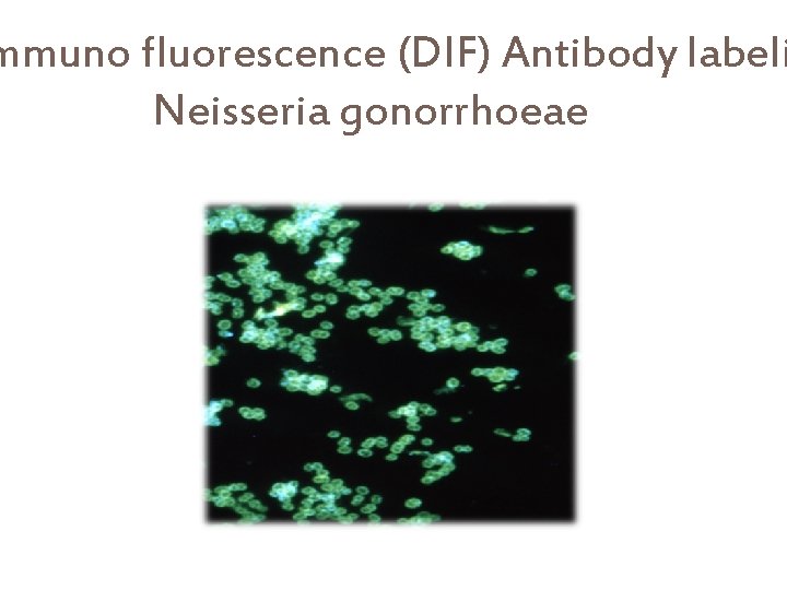 mmuno fluorescence (DIF) Antibody labeli Neisseria gonorrhoeae 