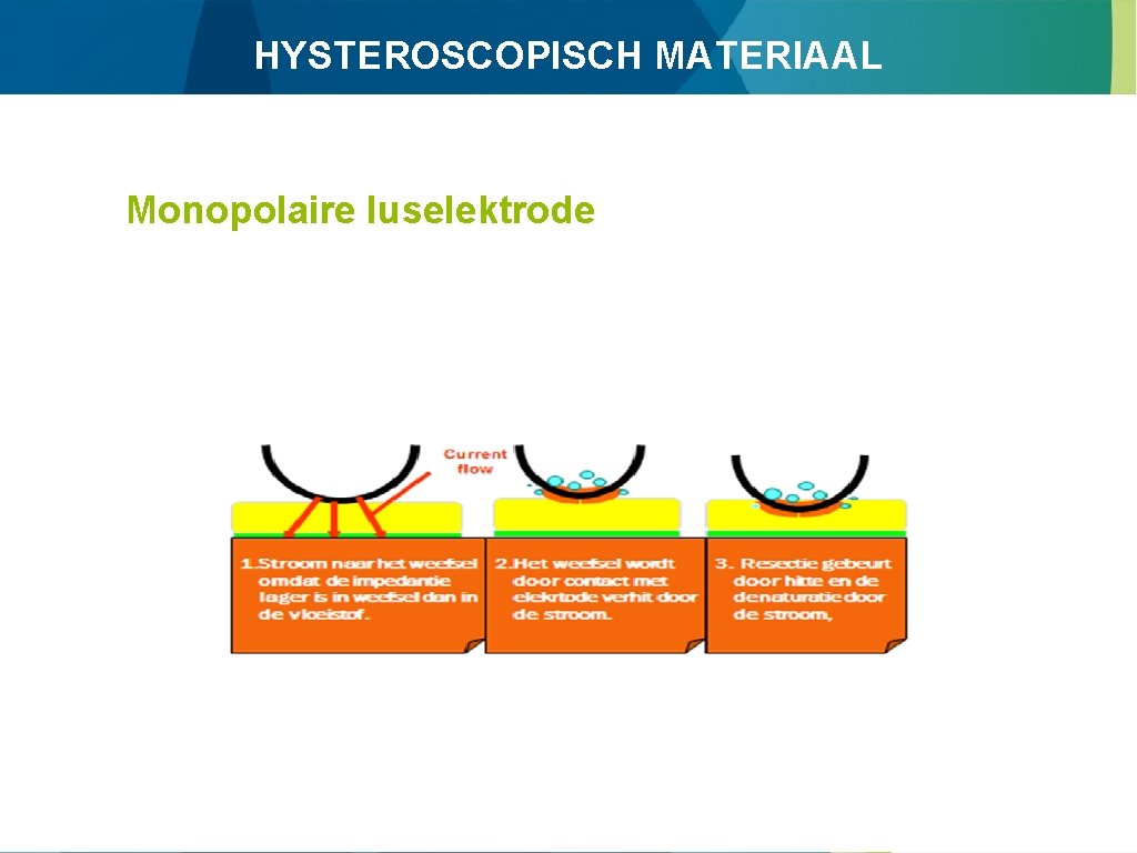 HYSTEROSCOPISCH MATERIAAL Monopolaire luselektrode 