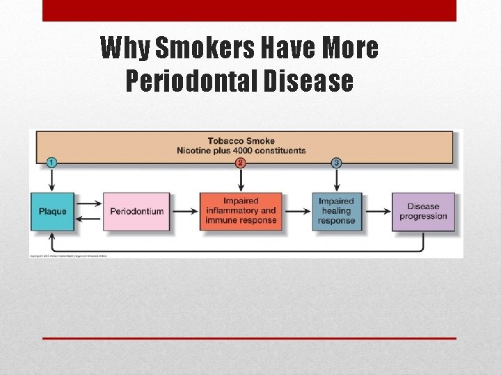 Why Smokers Have More Periodontal Disease 