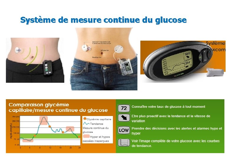 Système de mesure continue du glucose 