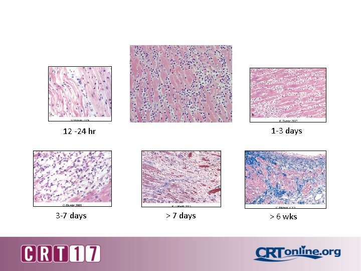 1 -3 days 12 -24 hr 3 -7 days > 6 wks 