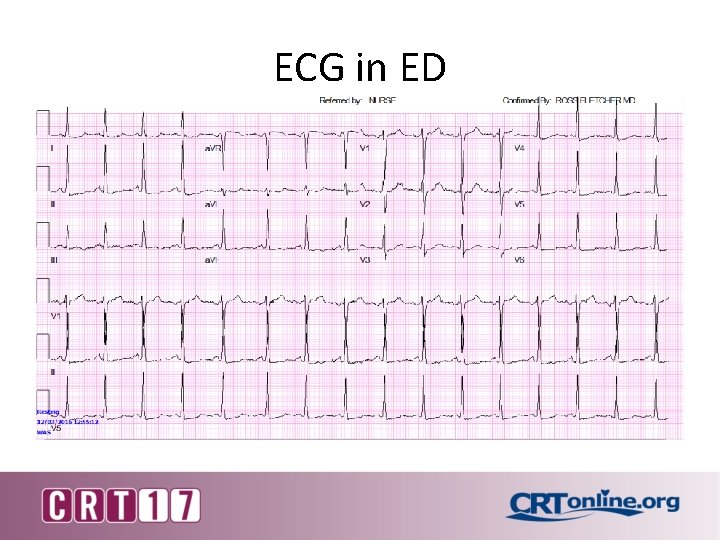 ECG in ED 