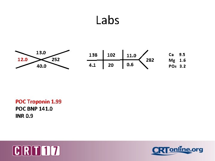 Labs 13. 0 12. 0 40. 0 252 POC Troponin 1. 99 POC BNP