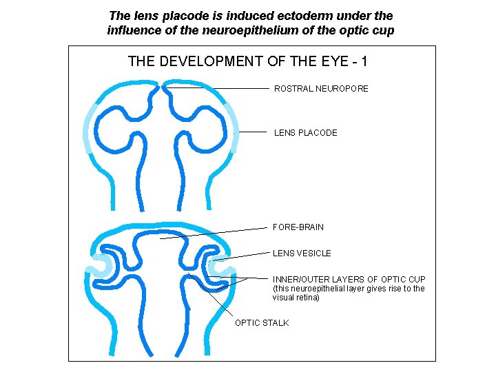 The lens placode is induced ectoderm under the influence of the neuroepithelium of the