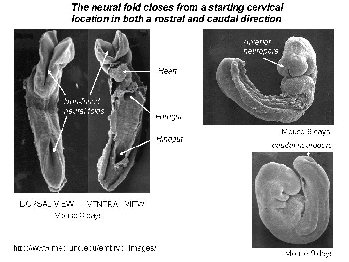 The neural fold closes from a starting cervical location in both a rostral and