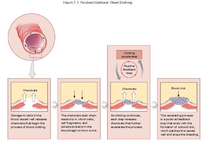 Figure 1 -4 Positive Feedback: Blood Clotting accelerates Positive feedback loop Chemicals Damage to