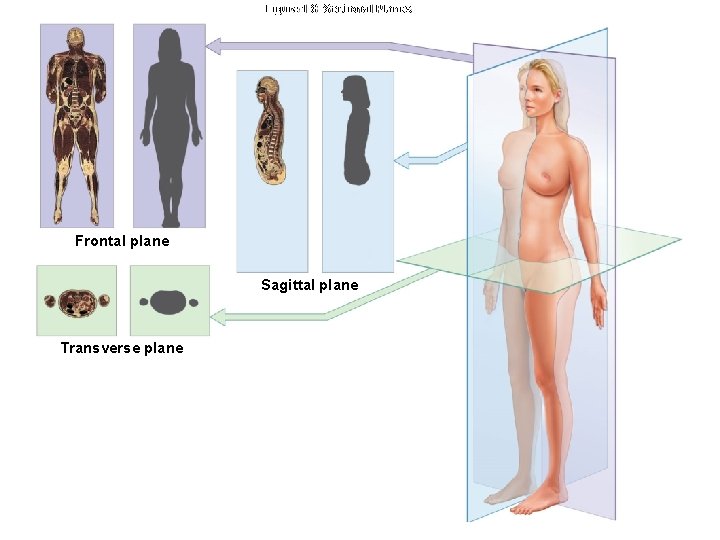 Figure 1 -8 Sectional Planes Frontal plane Sagittal plane Transverse plane 