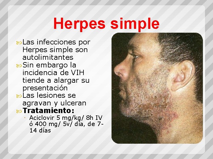 Herpes simple Las infecciones por Herpes simple son autolimitantes Sin embargo la incidencia de