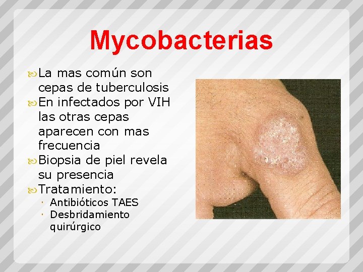 Mycobacterias La mas común son cepas de tuberculosis En infectados por VIH las otras