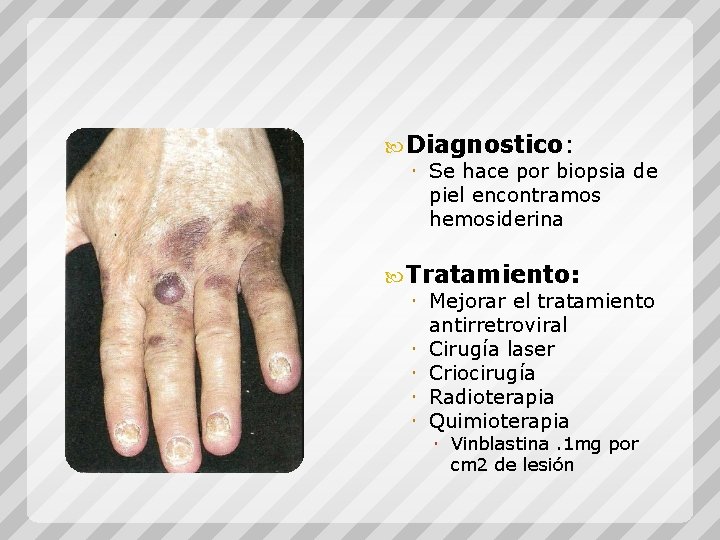  Diagnostico: Se hace por biopsia de piel encontramos hemosiderina Tratamiento: Mejorar el tratamiento