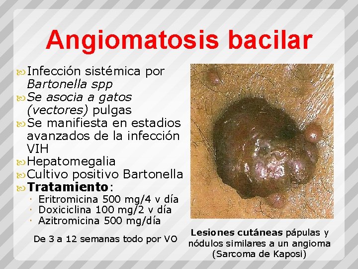 Angiomatosis bacilar Infección sistémica por Bartonella spp Se asocia a gatos (vectores) pulgas Se