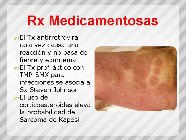 Rx Medicamentosas El Tx antirretroviral rara vez causa una reacción y no pasa de