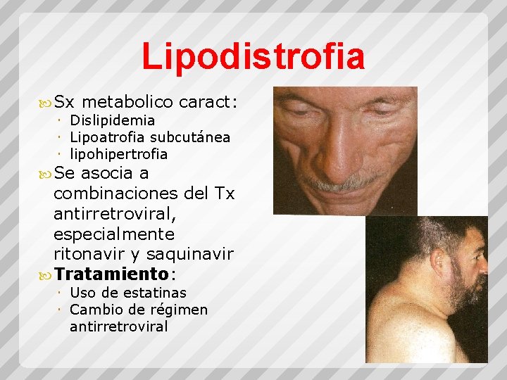 Lipodistrofia Sx metabolico caract: Dislipidemia Lipoatrofia subcutánea lipohipertrofia Se asocia a combinaciones del Tx