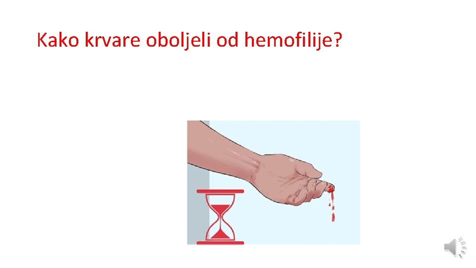 Kako krvare oboljeli od hemofilije? 