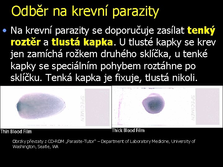 Odběr na krevní parazity • Na krevní parazity se doporučuje zasílat tenký roztěr a