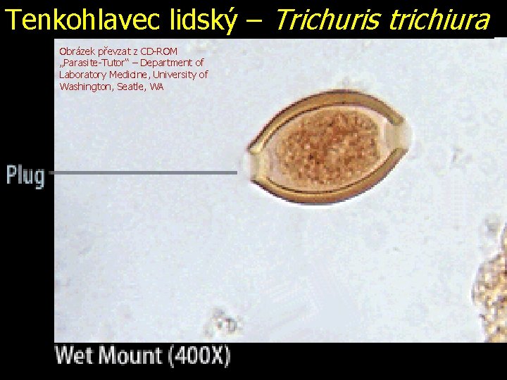 Tenkohlavec lidský – Trichuris trichiura Obrázek převzat z CD-ROM „Parasite-Tutor“ – Department of Laboratory