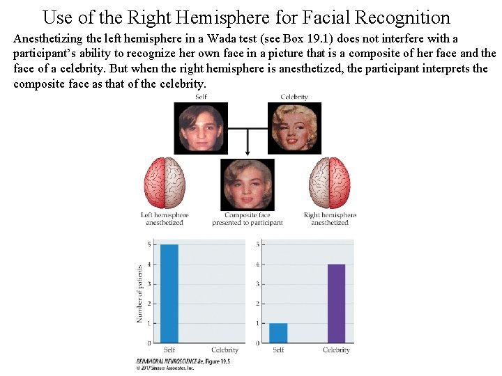 Use of the Right Hemisphere for Facial Recognition Anesthetizing the left hemisphere in a