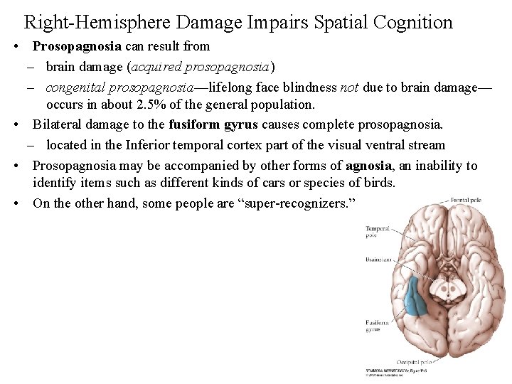 Right-Hemisphere Damage Impairs Spatial Cognition • Prosopagnosia can result from – brain damage (acquired