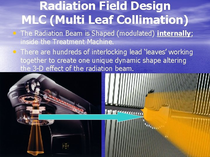 Radiation Field Design MLC (Multi Leaf Collimation) • The Radiation Beam is Shaped (modulated)