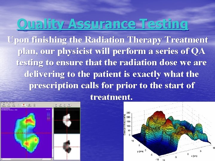 Quality Assurance Testing Upon finishing the Radiation Therapy Treatment plan, our physicist will perform