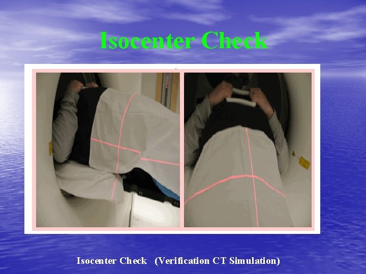 Isocenter Check (Verification CT Simulation) 