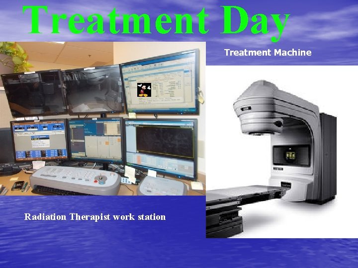 Treatment Day Treatment Machine Radiation Therapist work station 