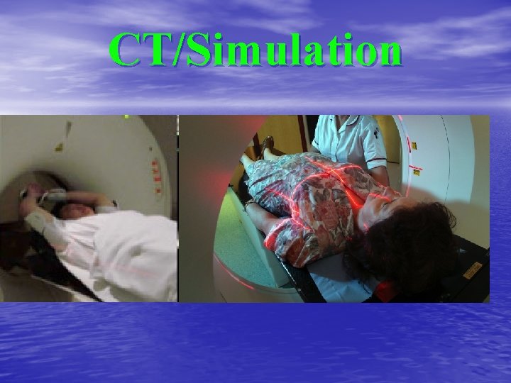CT/Simulation 