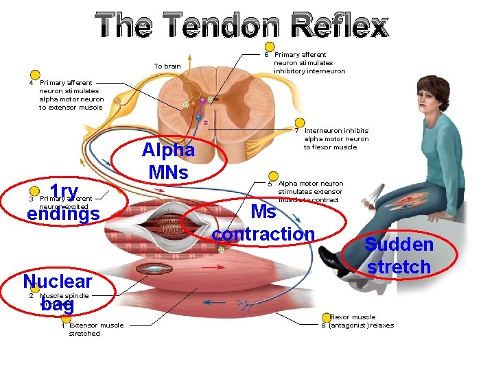 The Tendon Reflex To brain 6 Primary afferent neuron stimulates inhibitory interneuron 4 Primary