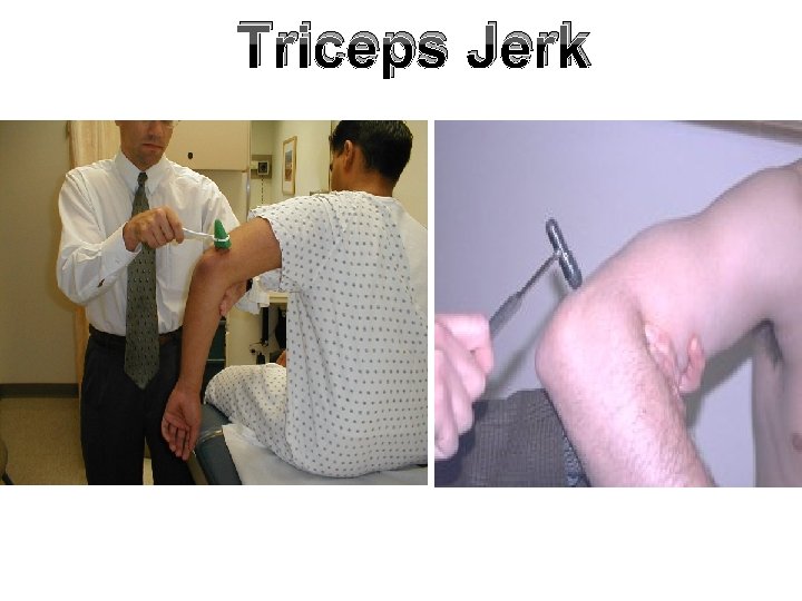 Triceps Jerk 