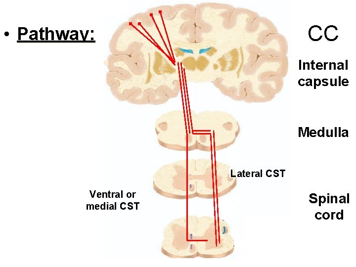 CC • Pathway: Internal capsule Medulla Lateral CST Ventral or medial CST Spinal cord