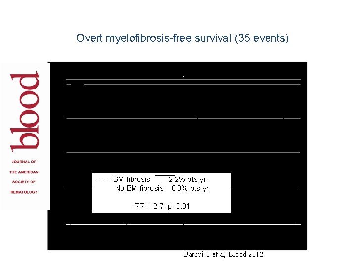 Overt myelofibrosis-free survival (35 events) ------ BM fibrosis 2. 2% pts-yr No BM fibrosis