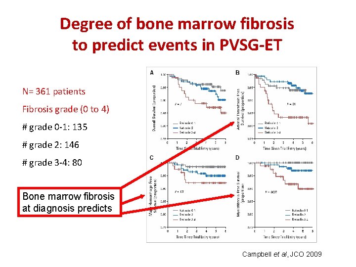 Degree of bone marrow fibrosis to predict events in PVSG-ET N= 361 patients Fibrosis