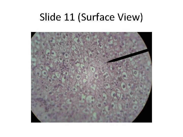 Slide 11 (Surface View) 