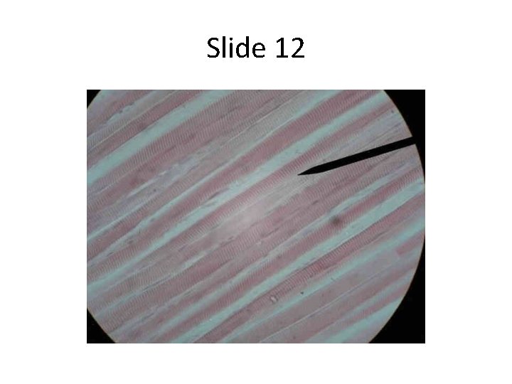 Slide 12 