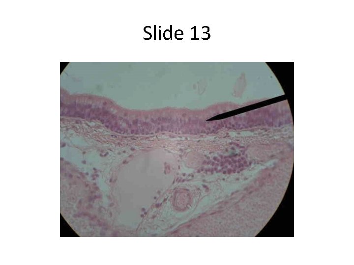 Slide 13 